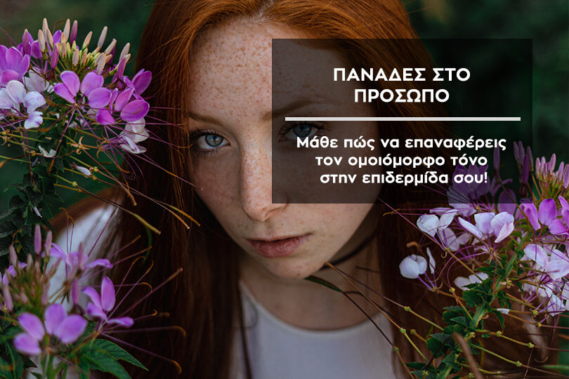 Πανάδες στο πρόσωπο. Αντιμετωπίστε τες με φυσικό τρόπο